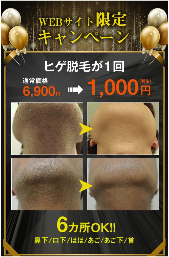 脱毛
