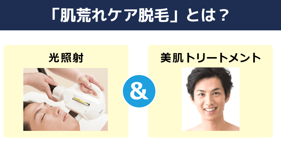 ラ・パルレ