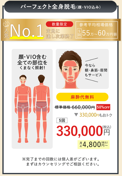 オススメ│全身脱毛・VIO脱毛